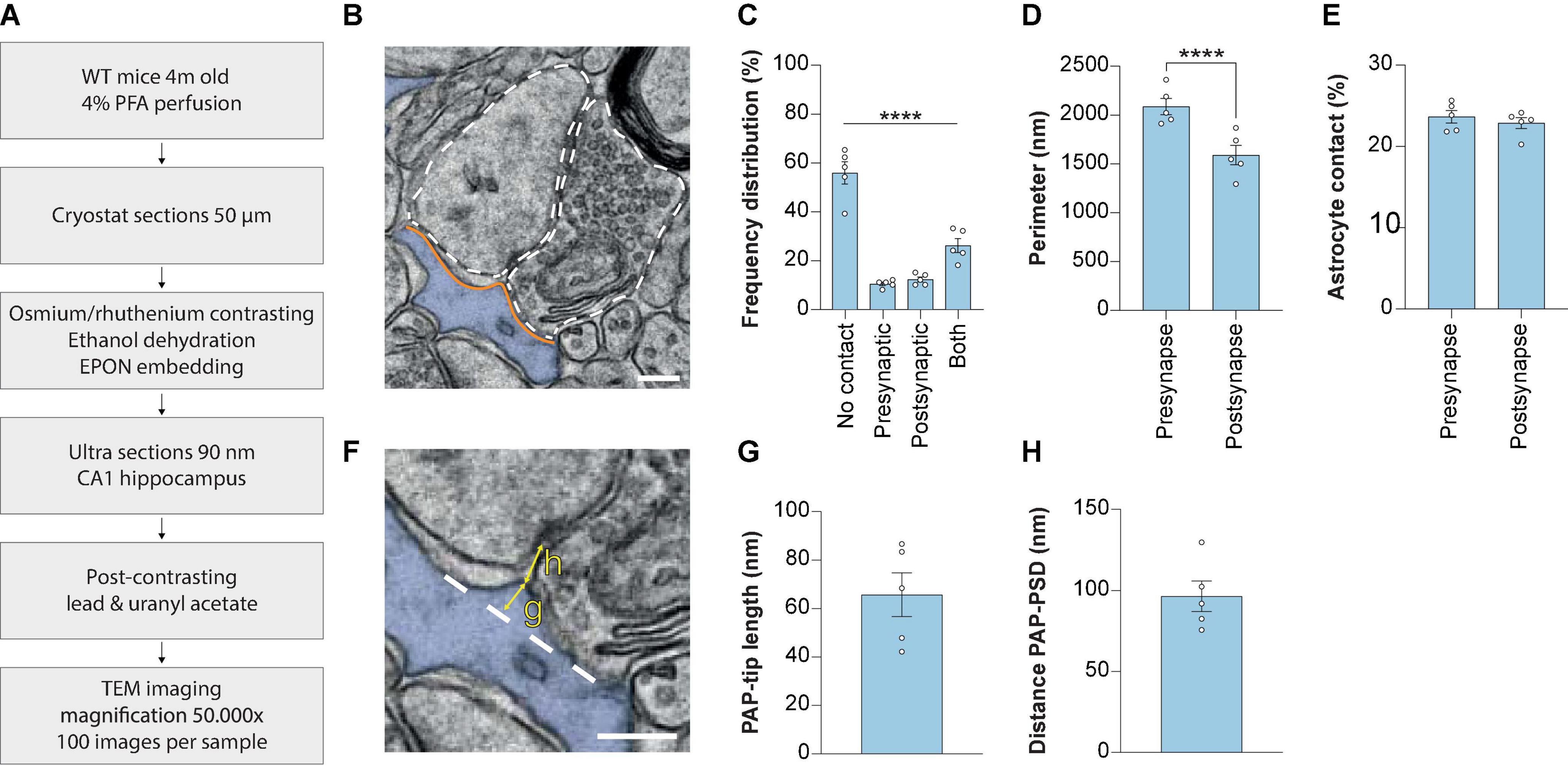 Electron microscopy analysis of astrocyte-synapse interactions shows altered dynamics in an Alzheimer’s disease mouse model